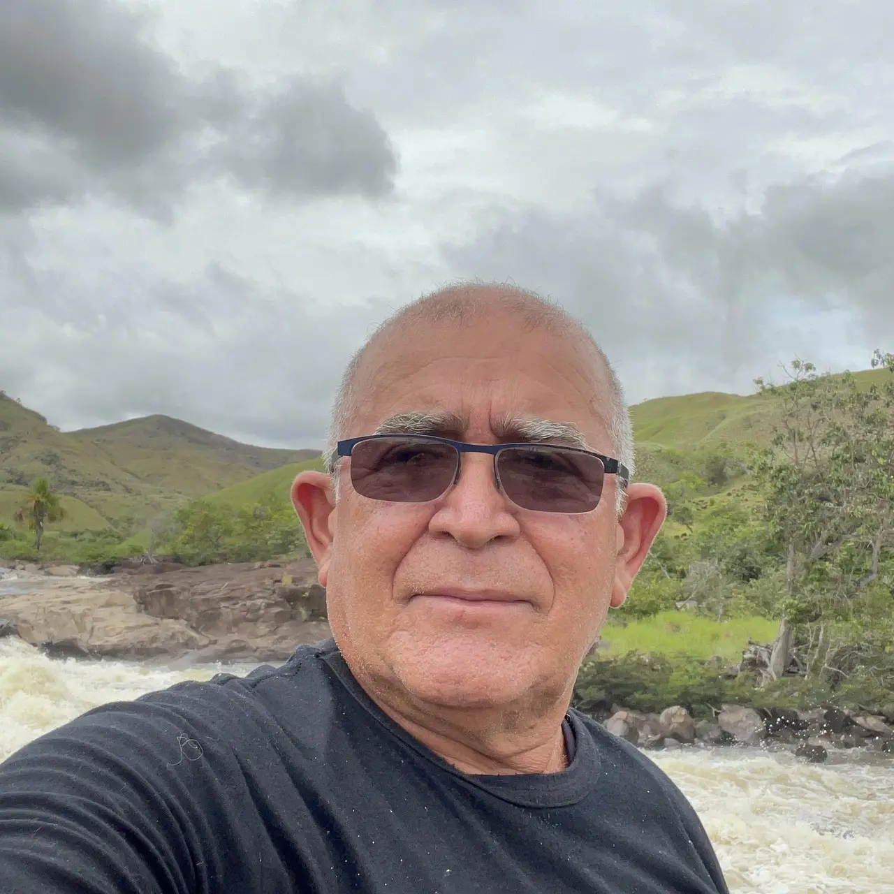 Toinho da Aderr. Candidato a prefeito de Amajari é baleado em atentado e passa por cirurgia em Roraima