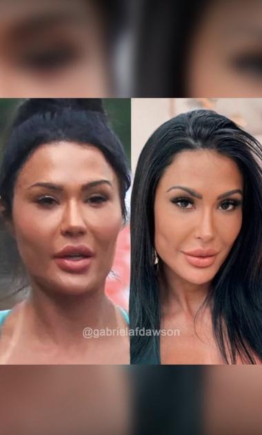 Gracyanne compartilhou antes e depois de seu rosto