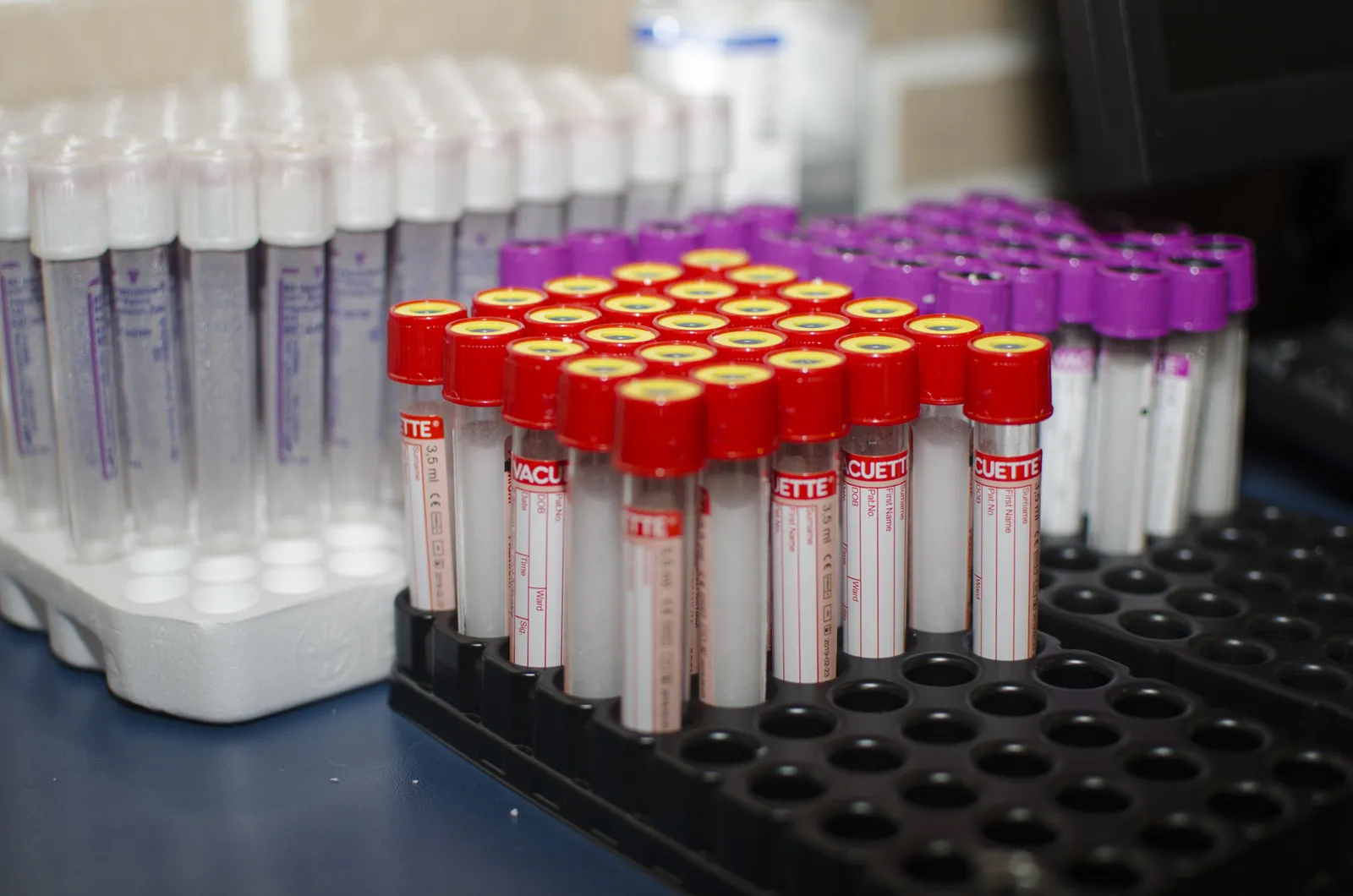 Exames de sangue de doadores de órgãos são feitos no Hemoce