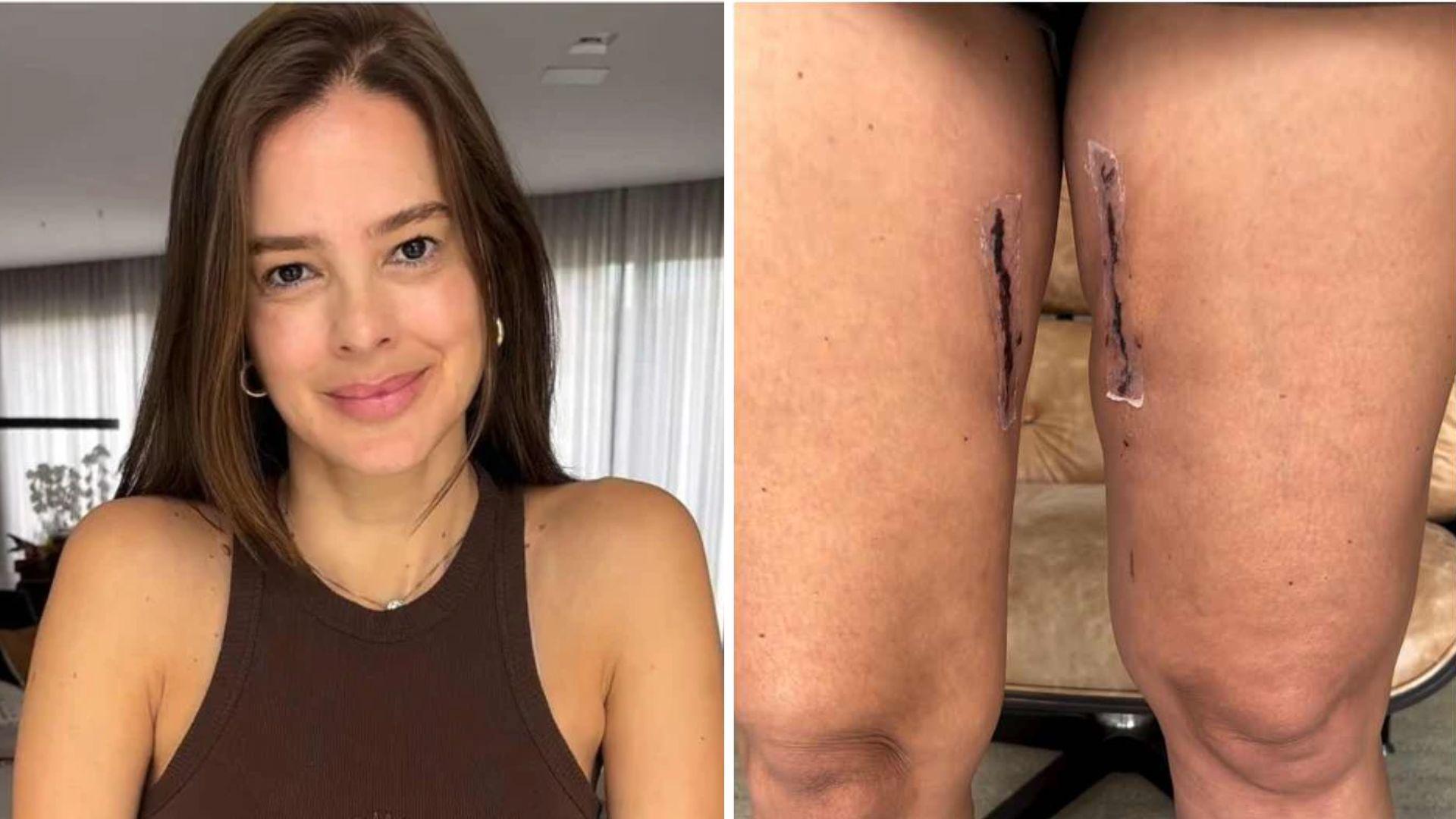 Vera Viel, esposa de Rodrigo Faro, mostra cicatrizes de sua cirurgia para tratar câncer; veja vídeo - Zoeira - Diário do Nordeste