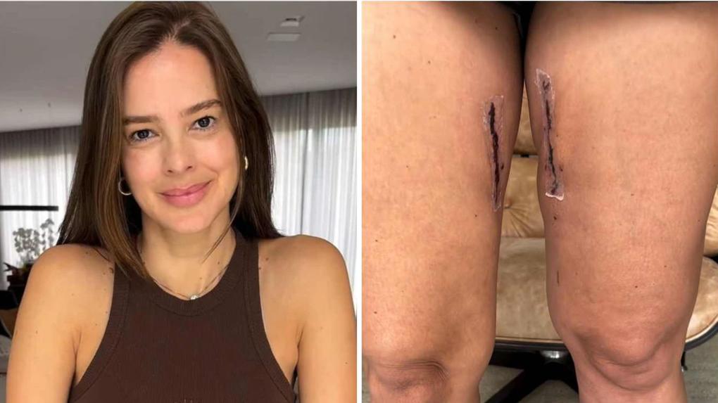 Vera Viel, esposa de Rodrigo Faro, mostra cicatrizes de sua cirurgia para tratar câncer; veja vídeo - Zoeira - Diário do Nordeste