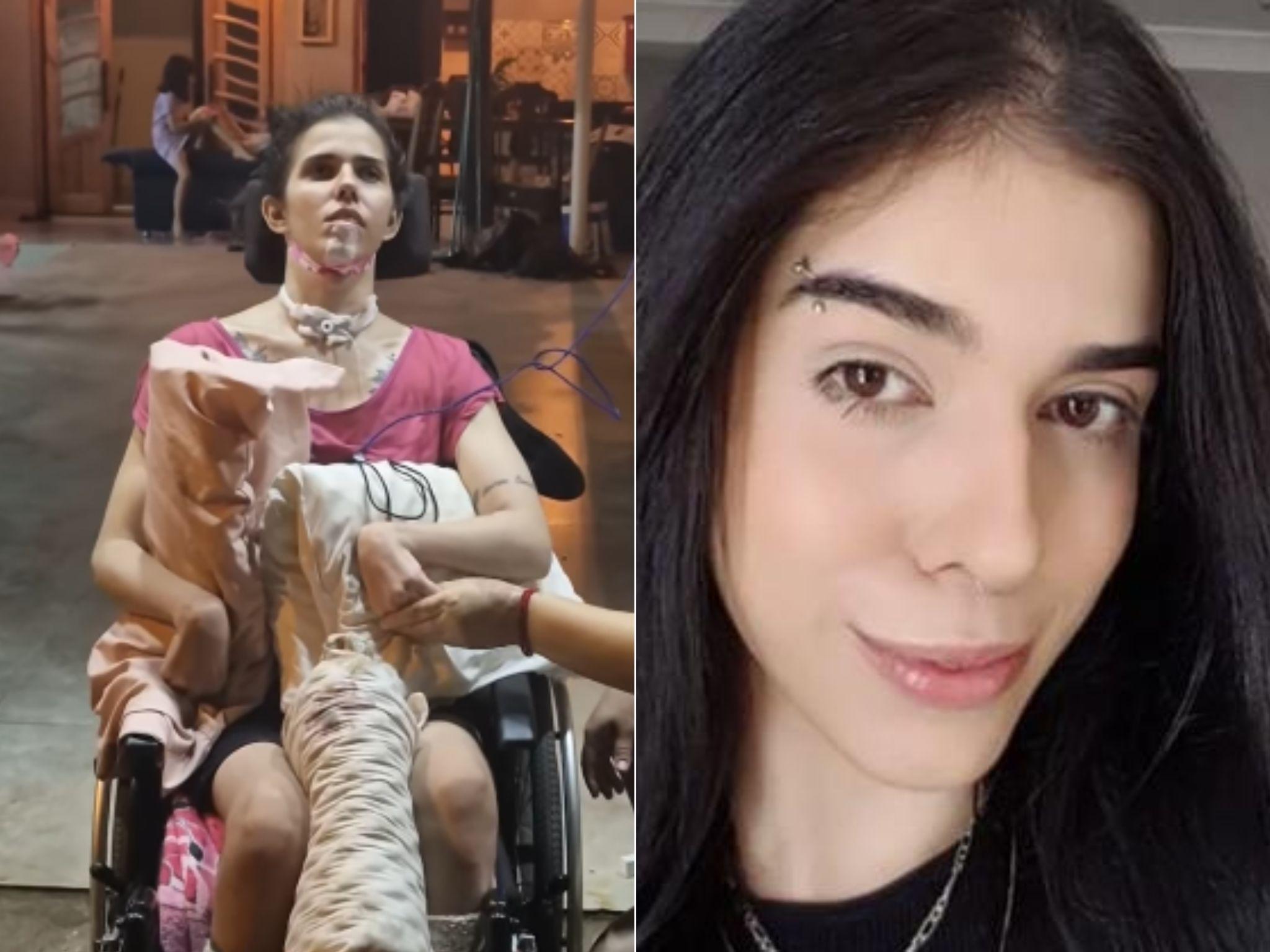 Desde que passou pela grave reação alérgica, Thais convive com sequelas motoras e cognitivas