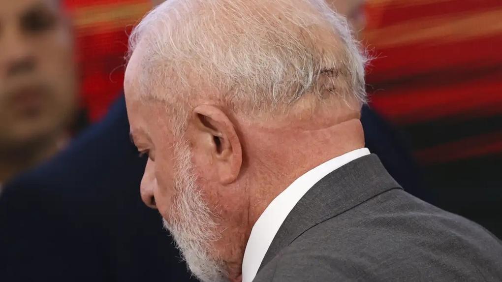Imagem mostra o presidente Lula de costas, onde é possível observar os pontos que ele levou na nuca após acidente doméstico em outubro deste ano. Lula passa por cirurgia às pressas e está internado em UTI após sentir dor de cabeça