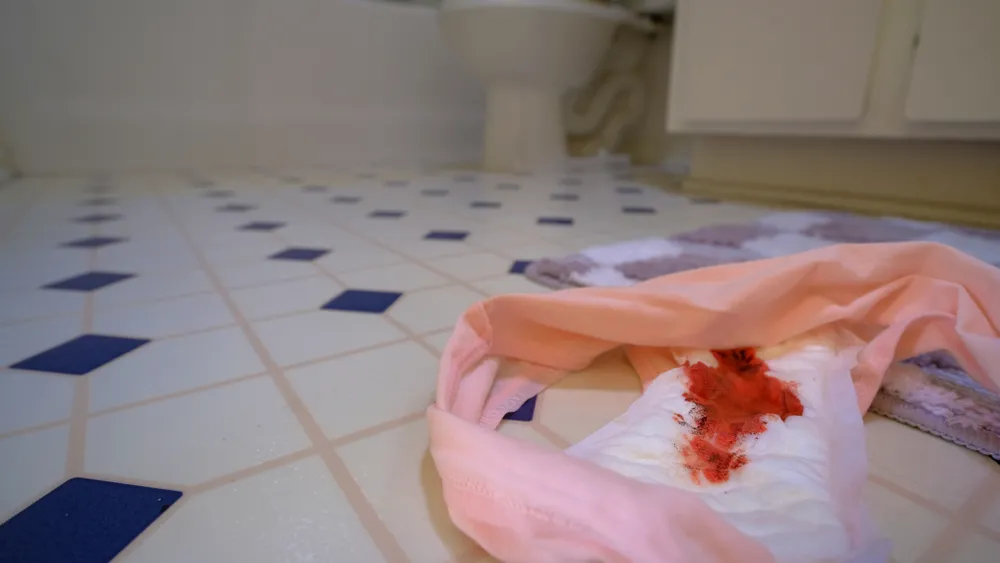 Endometriose pode causar cólica intensa, hemorragia durante o ciclo menstrual, distensão abdominal, gases e dor durante a relação sexual