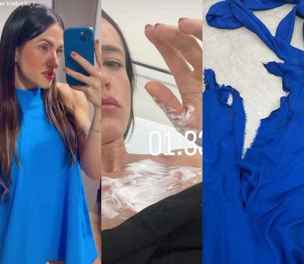 Turista atingida por fogos de artifício em SC perdeu pele do tórax: 'O vestido colou no corpo'