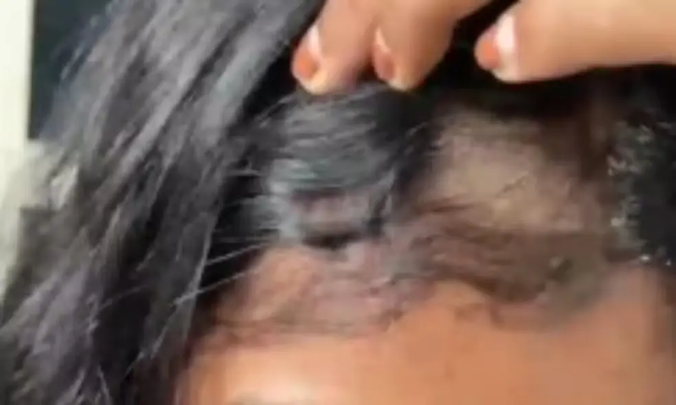 Cabelo raspado de aluna