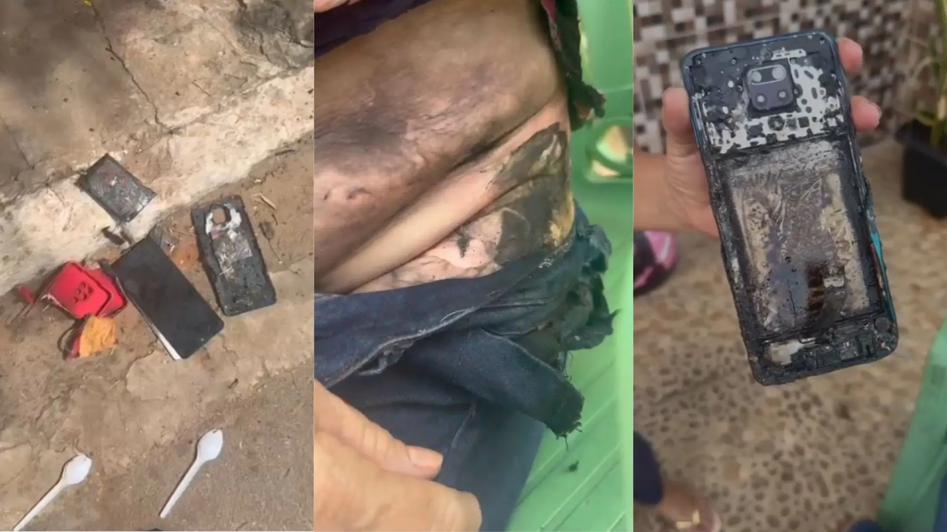 Imagem de um celular danificado e queimado, evidenciando danos em diferentes ângulos. A cena retrata riscos de explosão e ferimentos relacionados a aparelhos eletrônicos.
