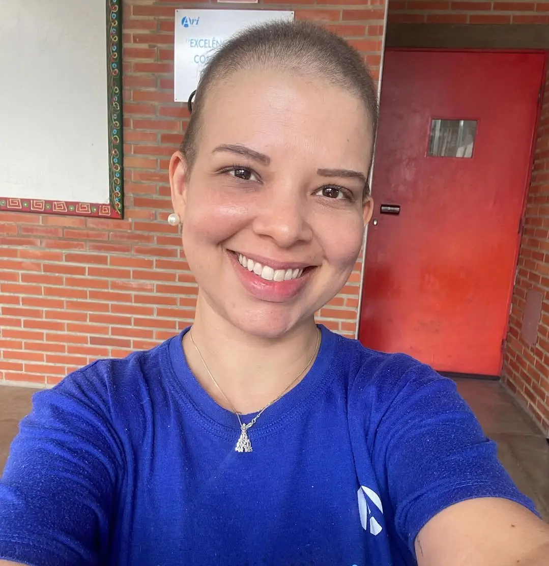 Mariana após perda de cabelo pela quimioterapia