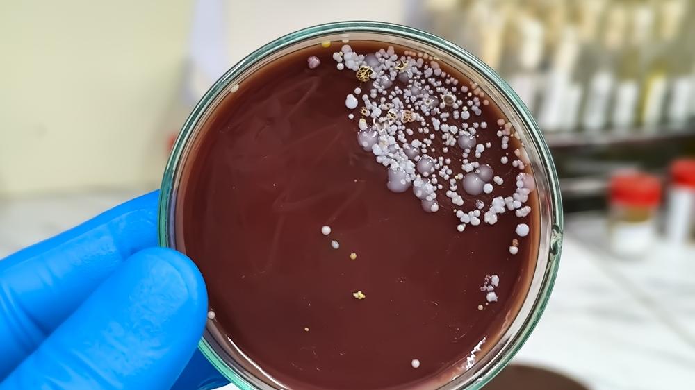 cientista segura amosta do superfungo Candida auris