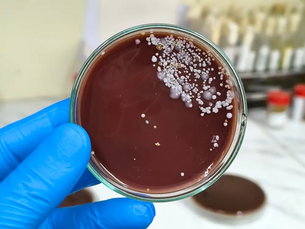 cientista segura amosta do superfungo Candida auris