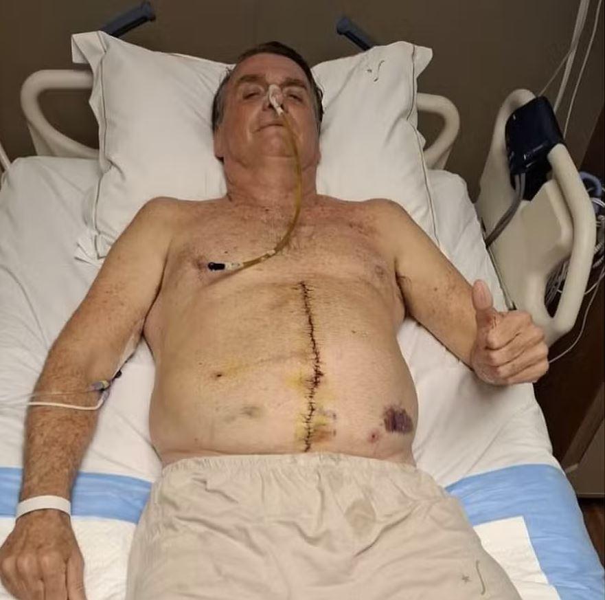 Bolsonaro internado em UTI de hospital de Brasília