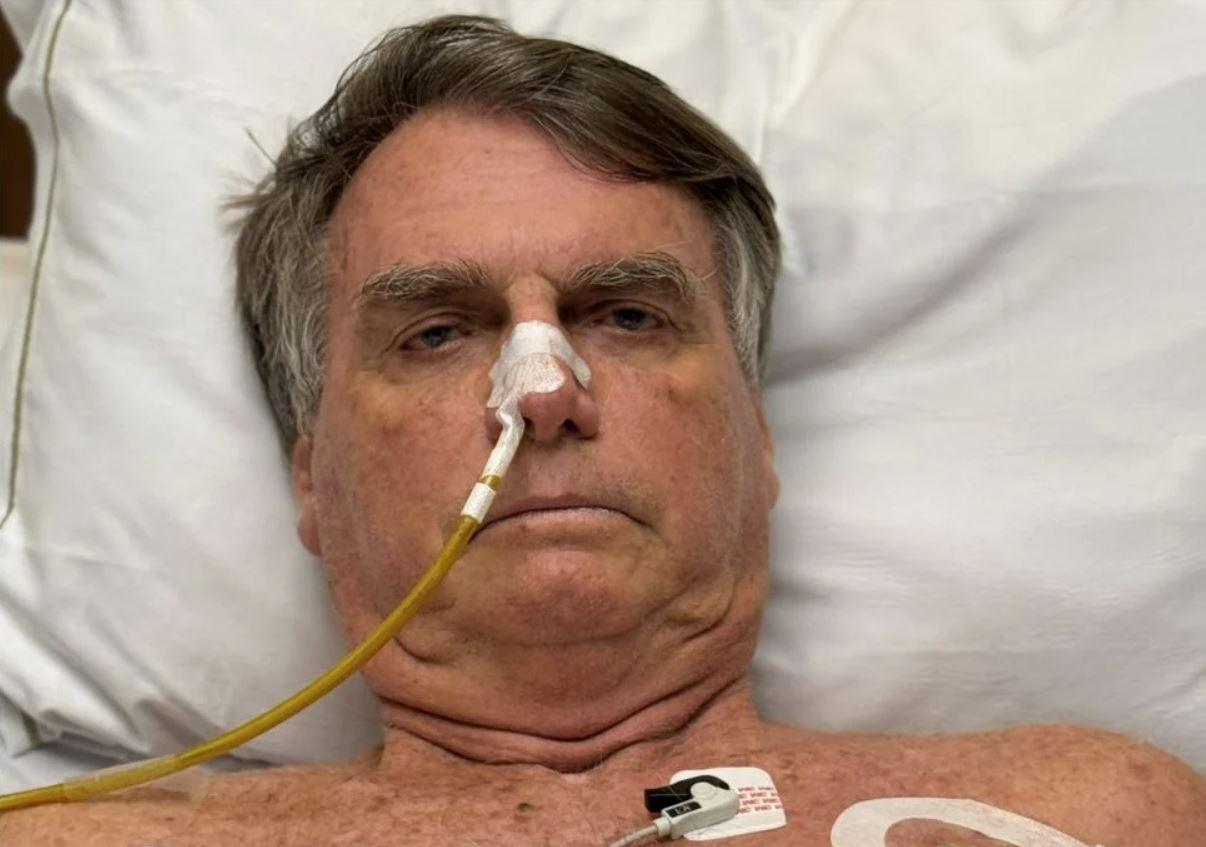 foto do ex-presidente Jair Bolsonaro internado em UTI em Brasília. Ele está deitado na maca do hospital com um acesso no nariz
