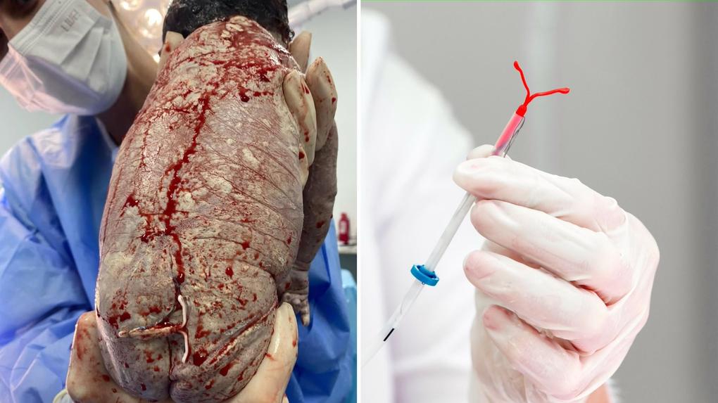 Imagem mostrando um órgão humano preservado e um especialista segurando uma seringa, evidenciando a conexão entre medicina e procedimentos cirúrgicos.