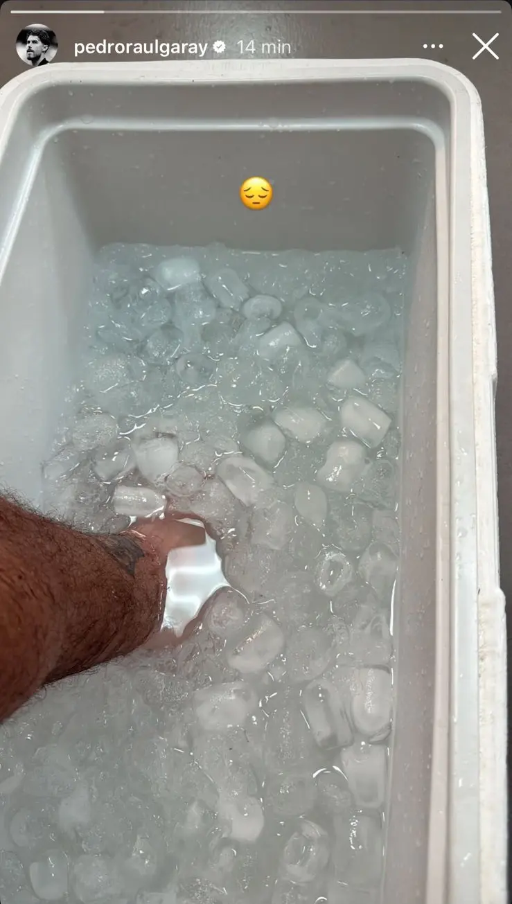 Pedro Raul posta foto de tratamento no gelo após lesão em jogo do Ceará