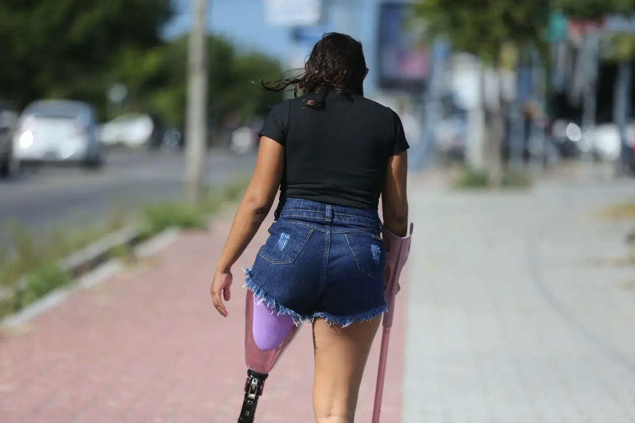A fotografia, capturada de costas, mostra uma mulher caminhando em uma calçada ensolarada. Ela veste uma camiseta preta e um short jeans desfiado. No lugar da perna direita, ela usa uma prótese com detalhes em roxo. Ao lado da prótese, é possível ver parte de uma muleta de cor rosa-claro. Ao fundo, carros e árvores embaçadas sugerem uma rua movimentada.