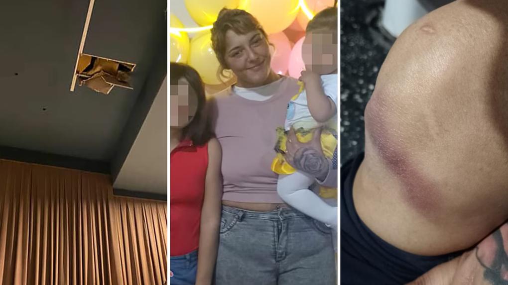 Imagem de teto de cinema que caiu em cima de aniversariante, ao lado da aniversariante na argentina, e uma imagem da lesão