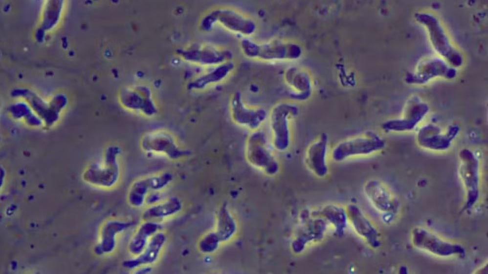 Imagem microscópica da ameba Naegleria fowleri, conhecida como 