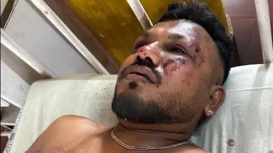 Vishwash Kumar Ramesh em uma maca num hospital, sobrevivente do acidente de avião na Índia