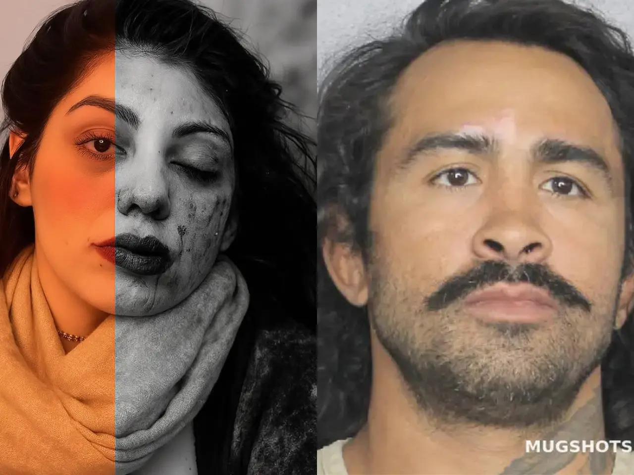 Foto do rosto de esposa de Pepey Godofredo machucado após agressão.