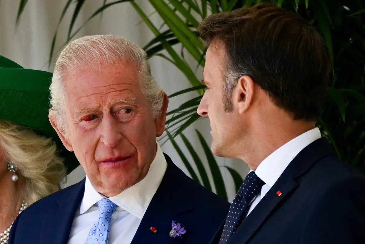 Imagem mostra rei Charles III com olho vermelho durante encontro com Macron