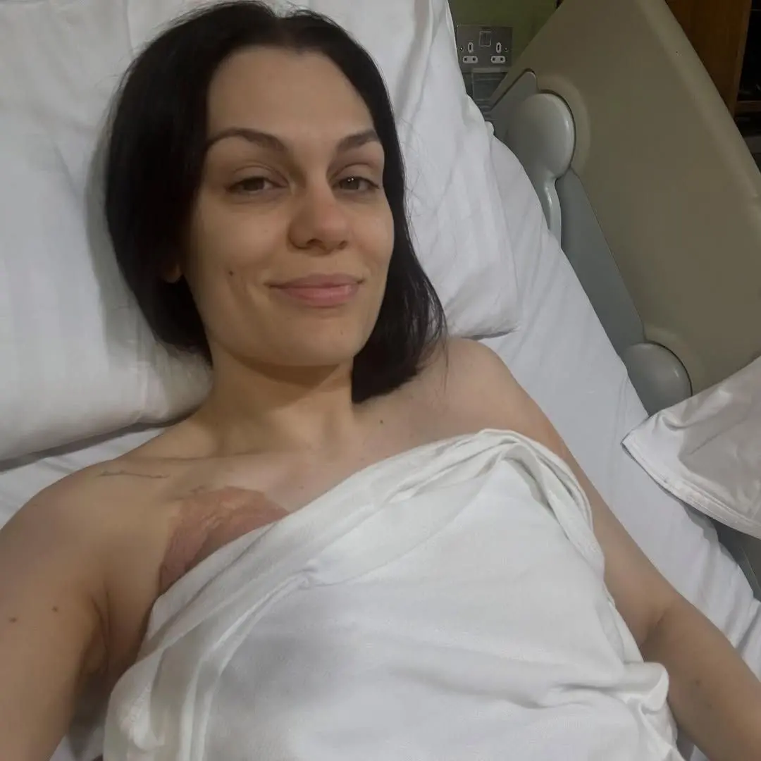 Imagem da notícia Jessie J confirma show no 'The Town' mesmo em recuperação de mastectomia