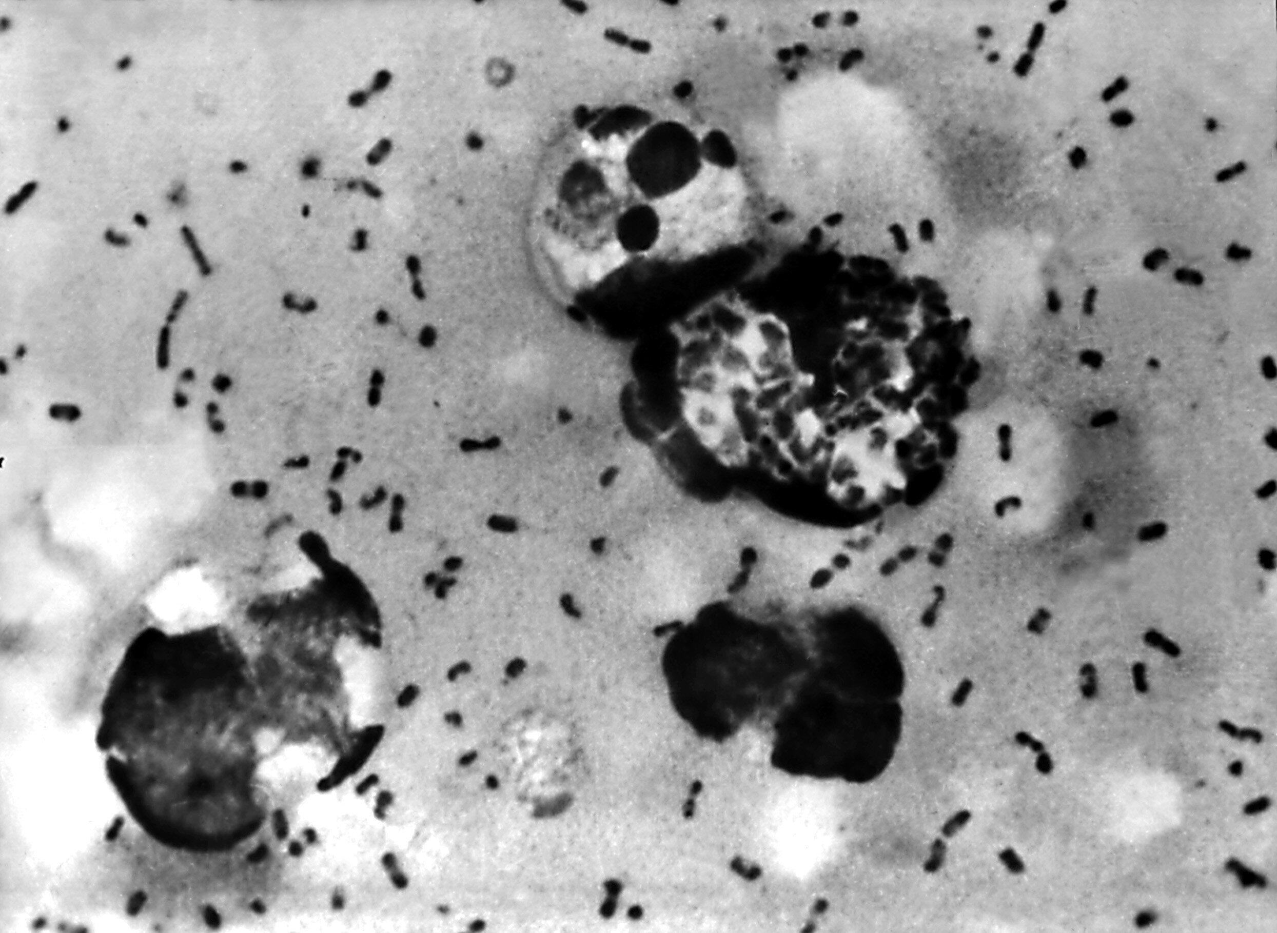 Yersinia pestis, bactéria que causa a peste bubônica