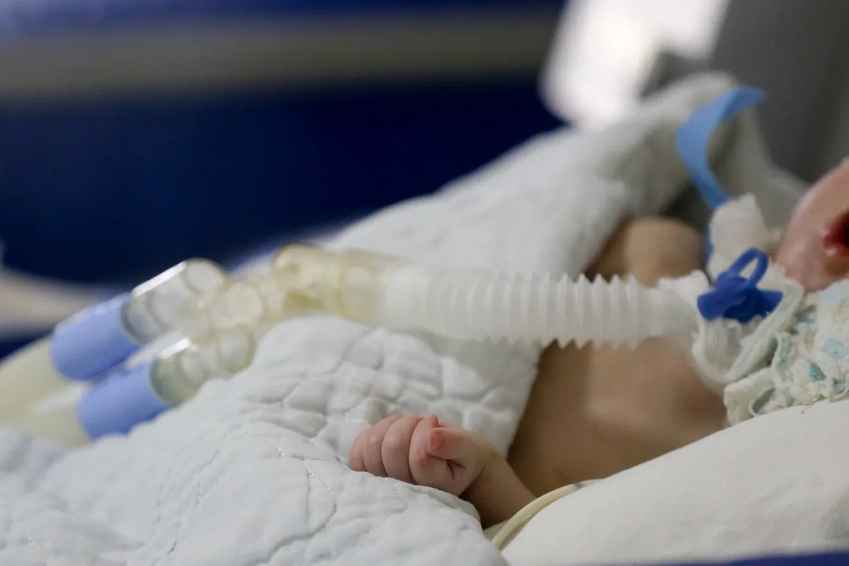 Maioria dos pacientes nessa situação vive em cuidados paliativos contínuos, destinados a doenças crônicas e de maior gravidade