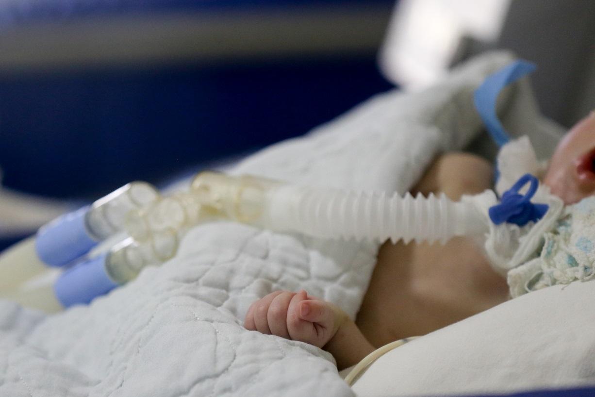 Foto mostra um bebê internado, deitado em uma cama, com a mão fechada sobre um cobertor branco. Ele está ligado a um tubo de respiração mecânica, indicando cuidados intensivos de saúde.