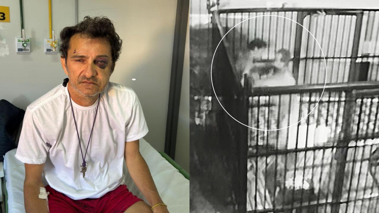 Alex Costa está vivendo de doações após ter sofrido agressão durante trabalho