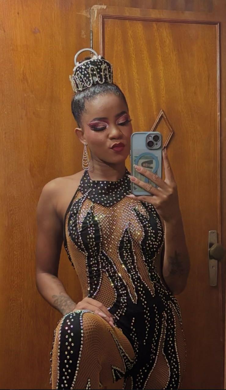 Uma artista circense sofreu uma queda enquanto fazia acrobacia aérea suspensa pelos cabelos