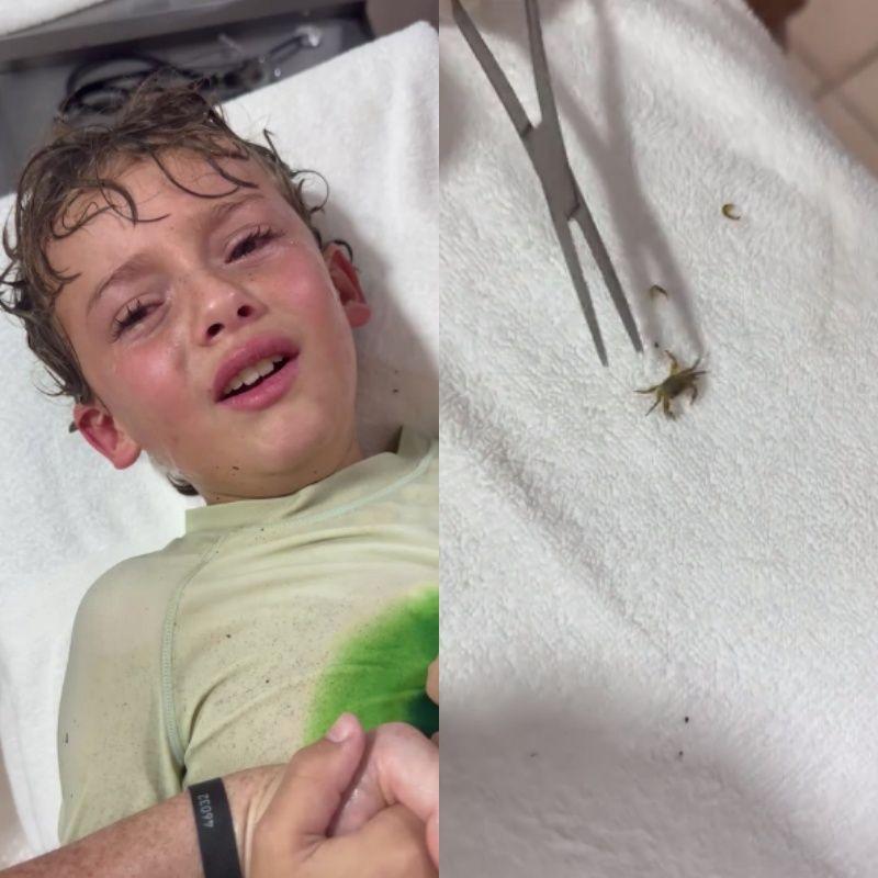 Mãe registrou o momento que o caranguejo é retirado do ouvido do filho