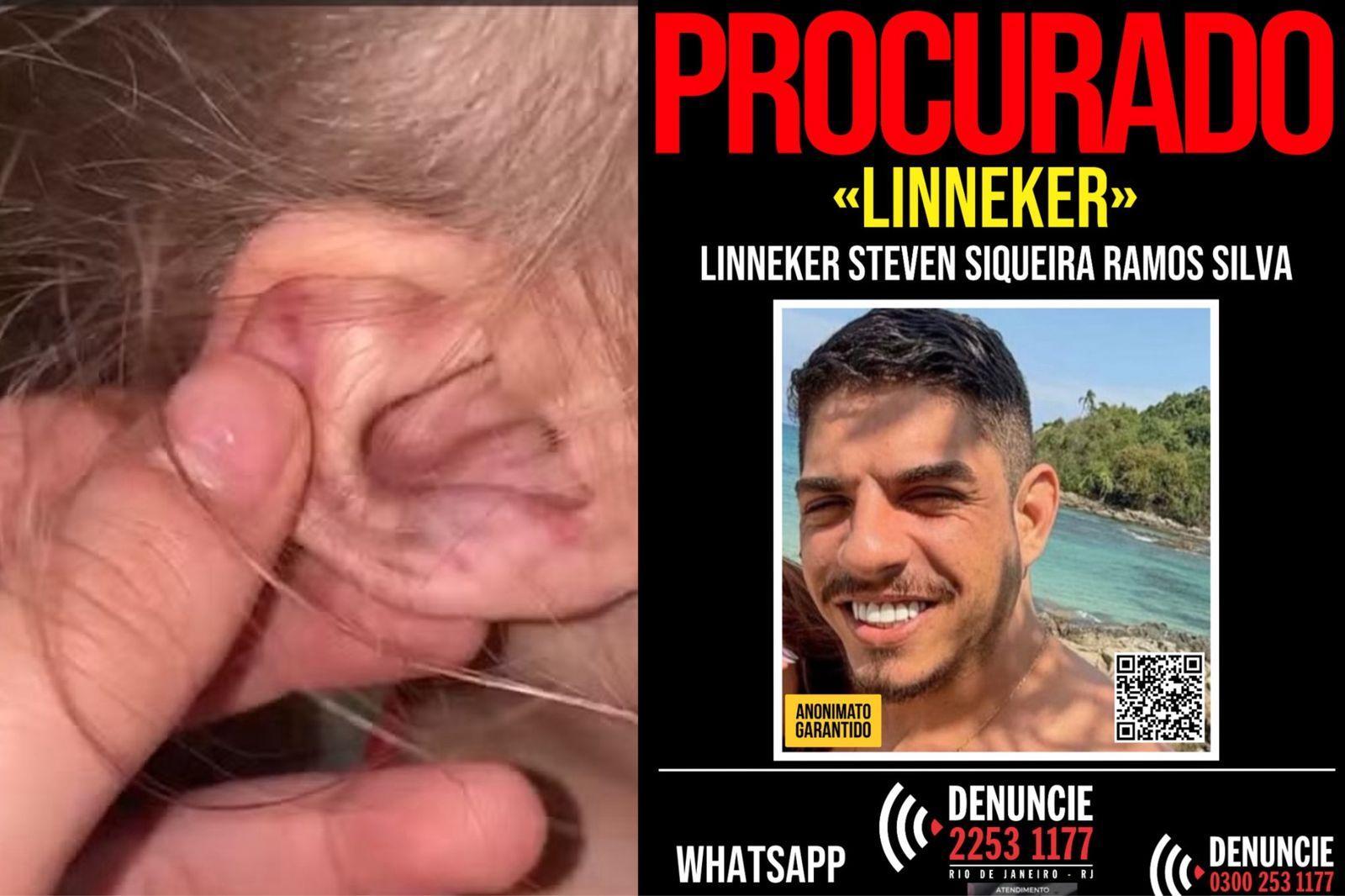 Imagem da orelha ferida de uma menina de três anos, ao lado de uma publicação sobre o procurado Linneker Steven Siqueira Ramos Silva, feita pelo disque denúncia