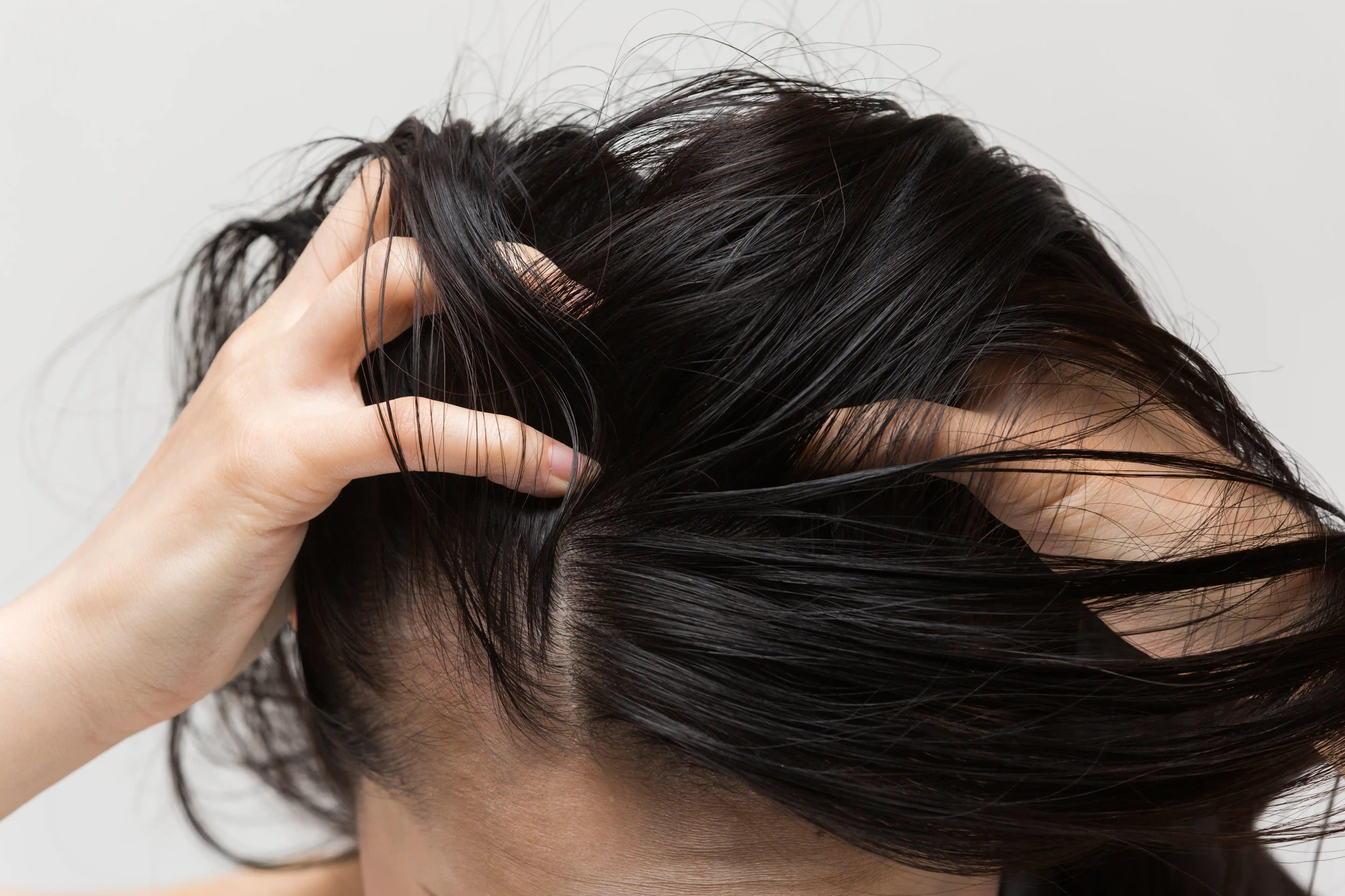 Coceira na cabeça o que pode ser: pessoa coçando o couro cabeludo.