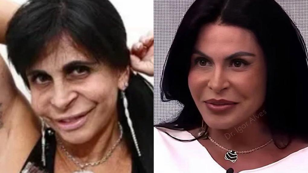 O antes e depois de Gretchen viralizou nas redes sociais