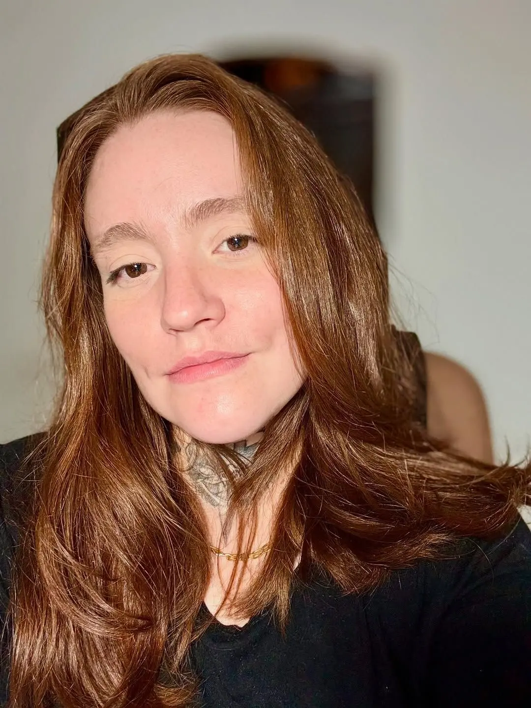 Imagem da notícia Influenciadora com 'pior dor do mundo' revela conversa com a filha sobre desejo de eutanásia
