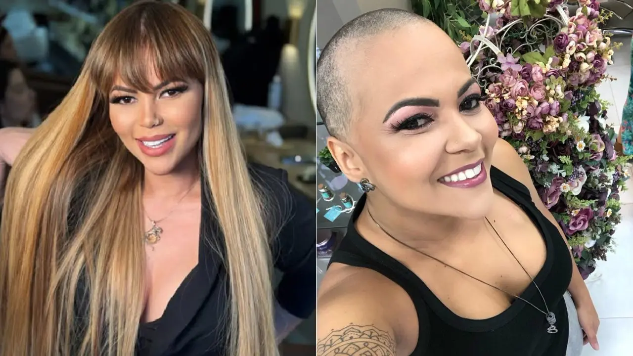 Montagem de Vanessa Rios com fotos dela com e sem cabelo após diagnóstico da doença