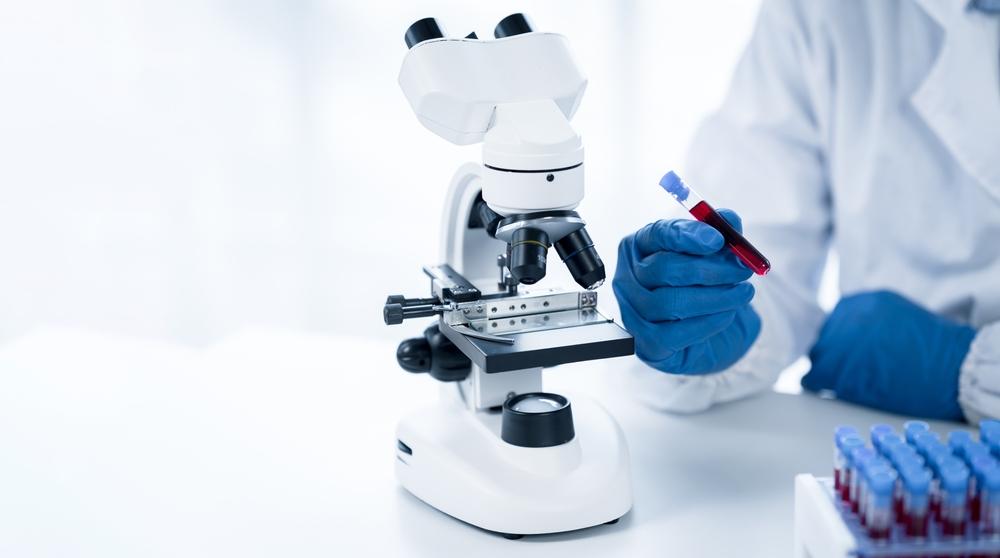 foto de pesquisador usando microscópio para realizar exame. Ele segura uma amostra de sangue.