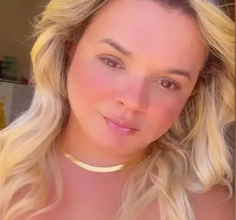 Imagem de Pamella dos Santos sorridente com cabelo loiro claro e pele renovada, usando colar dourado, em um ambiente ao ar livre.