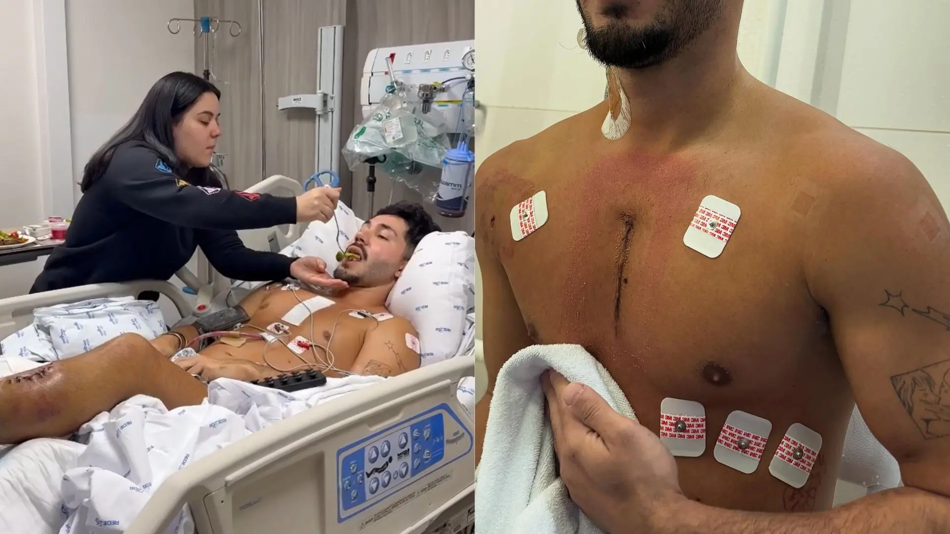 Imagens de Vittor Fernando após tentativa de homicídio.