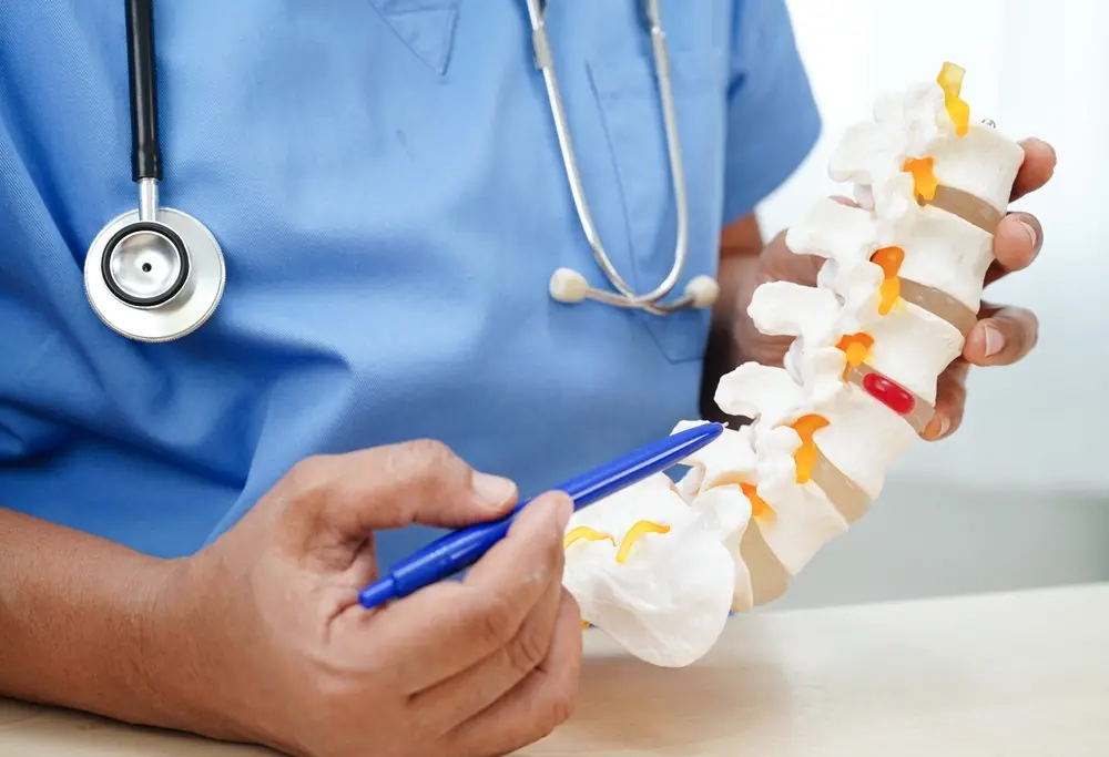 Médico aponta uma hérnia de disco em uma representação de coluna vertebral.