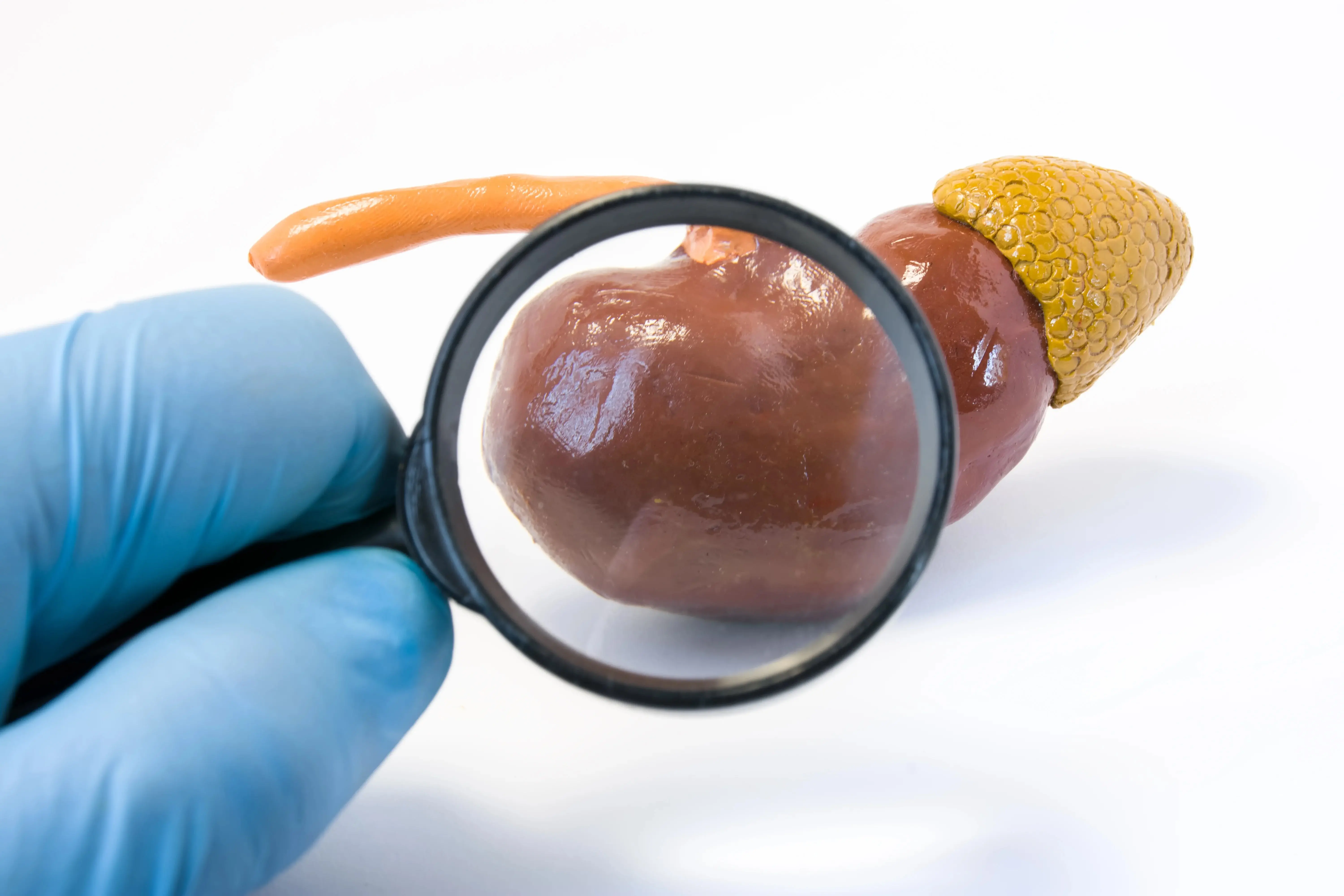 Imagem de um rim para uma matéria sobre síndrome nefrótica: o que é, principais causas, sintomas e tratamento.