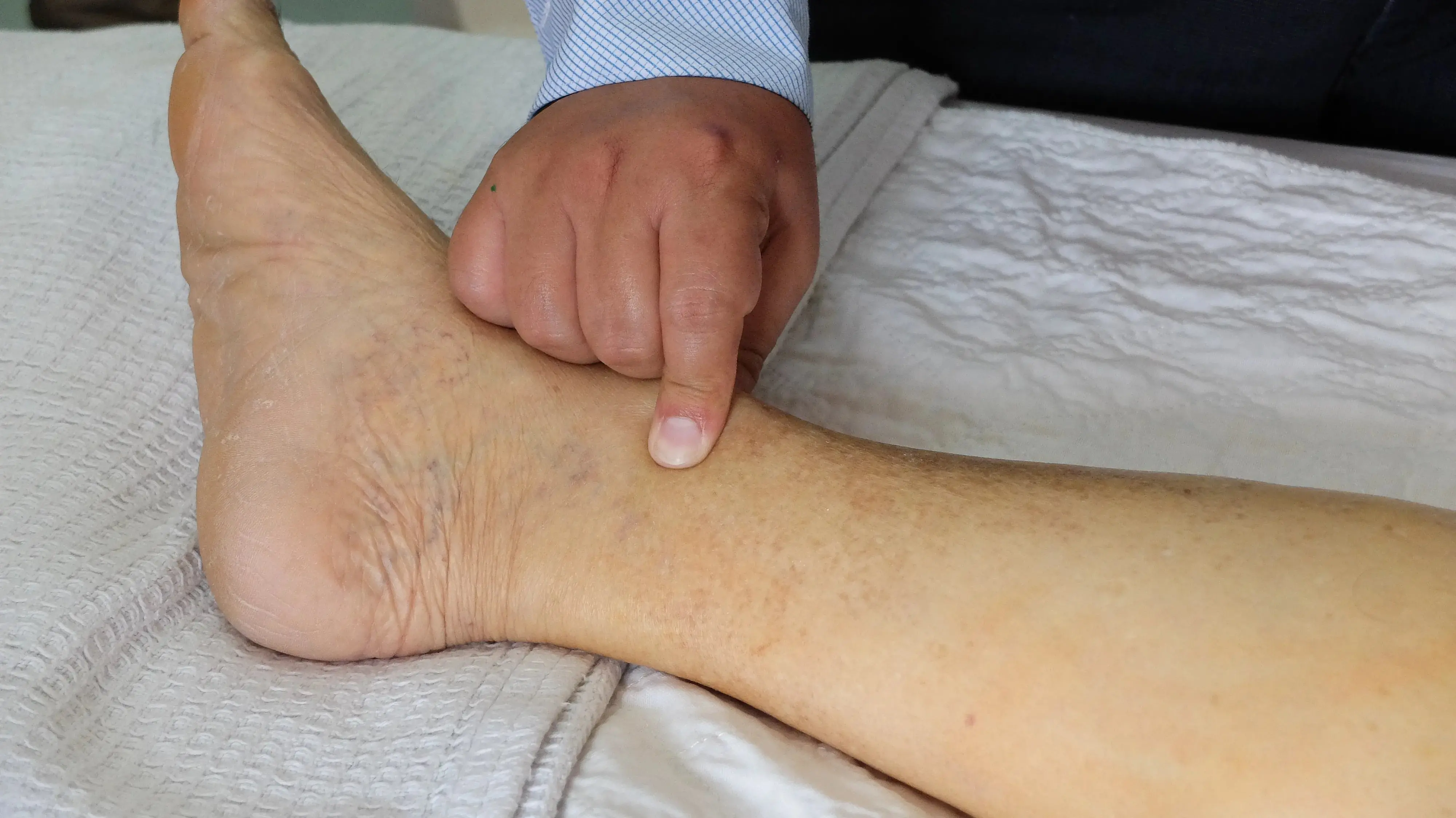 Imagem de um médico fazendo testes na perna de um paciente para uma matéria sobre síndrome nefrótica.