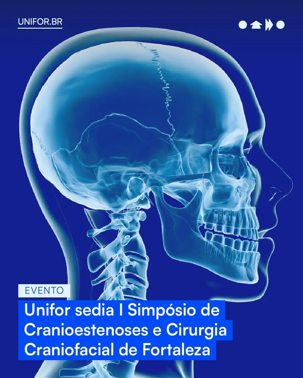 Imagem de divulgação do I Simpósio de Cranioestenose e Cirurgia Craniofacial de Fortaleza.
