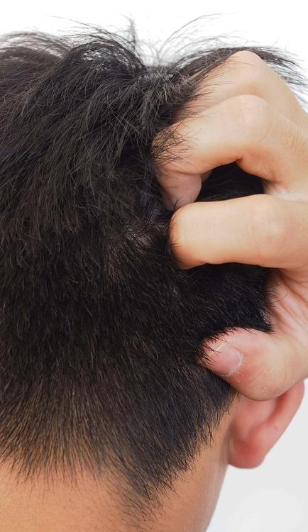 Homem coça o cabelo. Ele tem o cabelo preto.