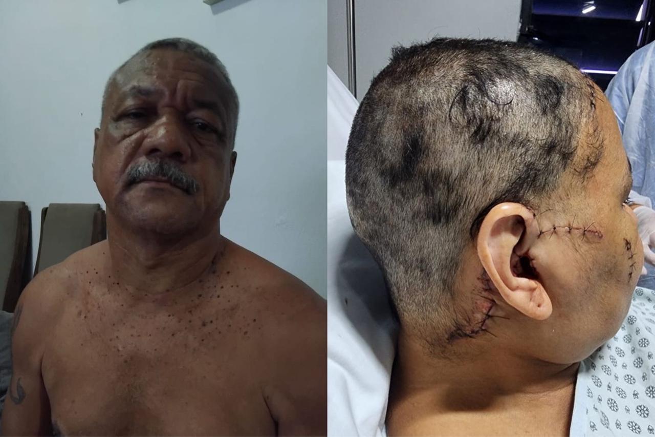 Homem que esfaqueou ex-namorada vai a júri popular em Fortaleza, ao lado da vítima, Elisângela