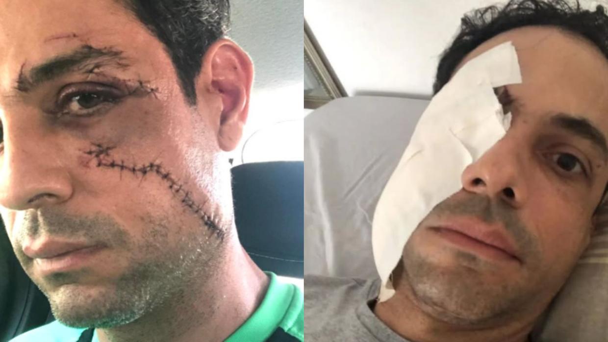 empresario agredido levou 62 pontos no rosto.