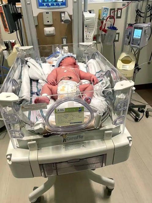 Grayson nasceu com mais de 7kg e precisou ficar internado na UTI neonatal. 