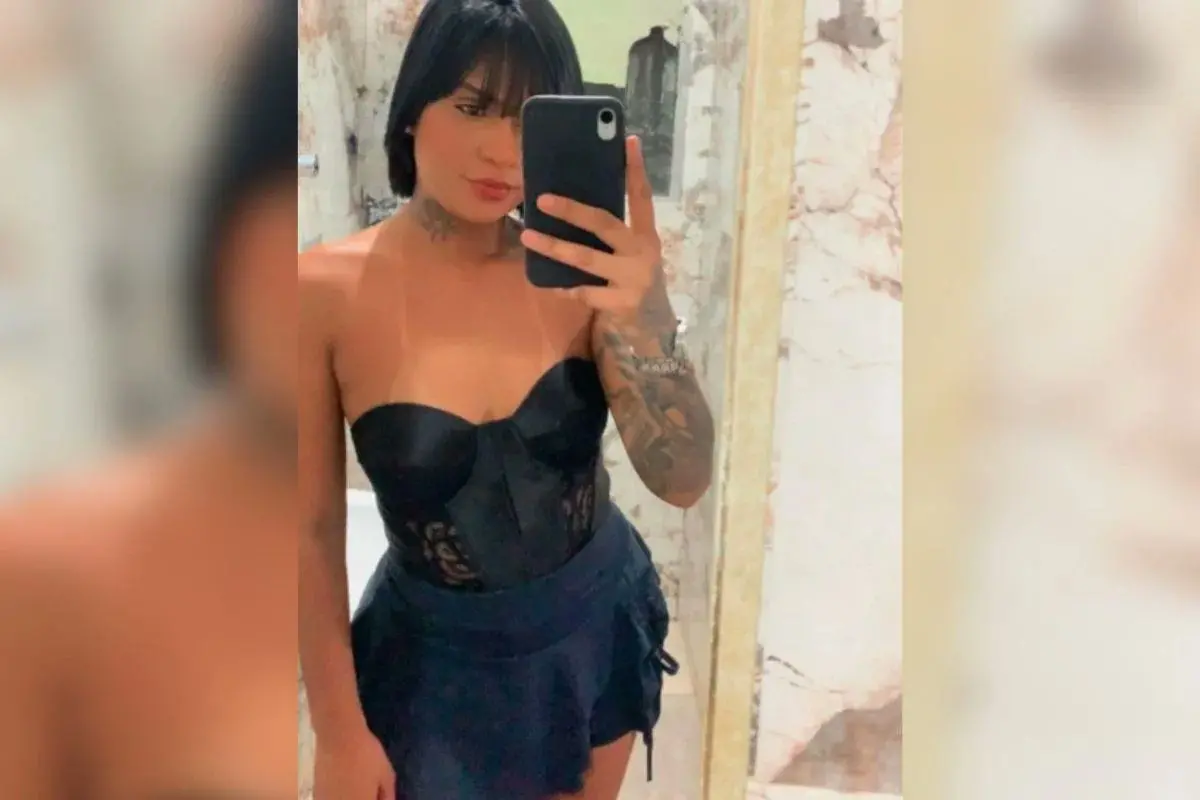 Tainara Souza passará por nova amputação, agora na altura da coxa, para possibilitar a reconstrução de parte dos glúteos. 