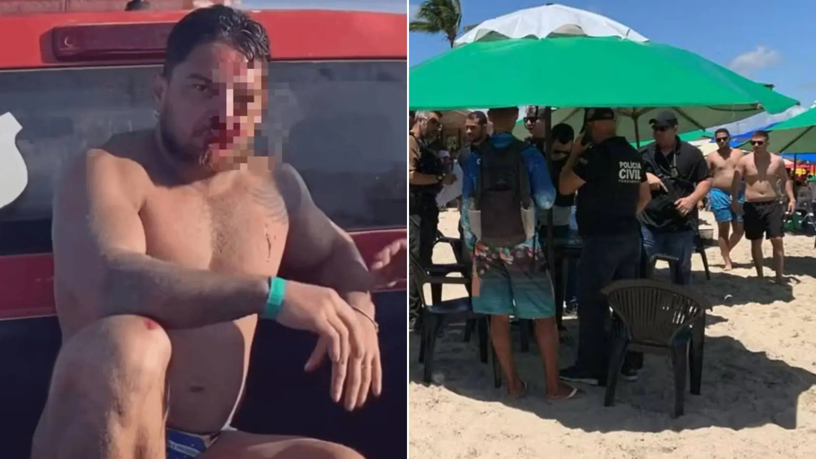 Imagem dividida mostrando turista ferido em barraca de Porto de Galinhas, com o rosto oculto, ao lado de imagem de um grupo de pessoas, incluindo policiais, na praia do porto de galinhas, em Pernambuco.