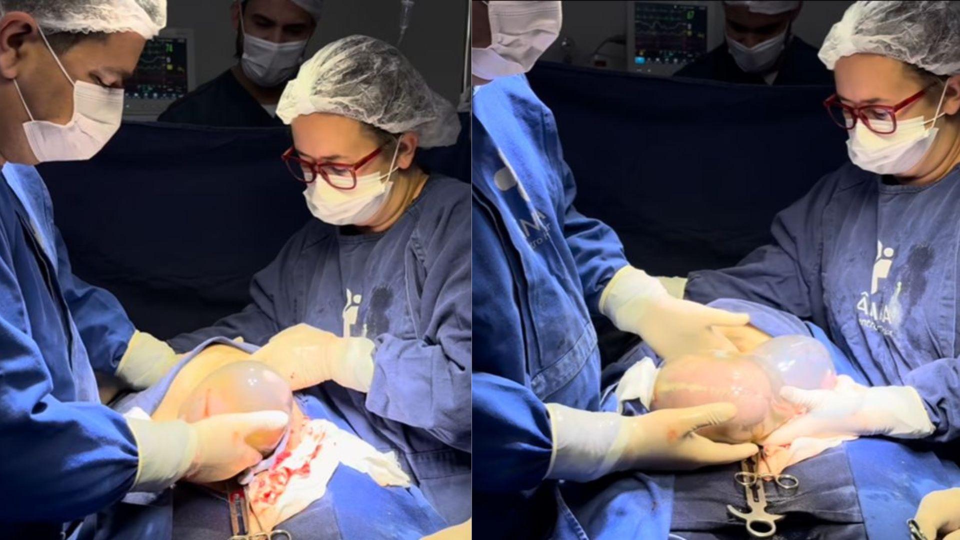 Imagem mostra o momento do parto.